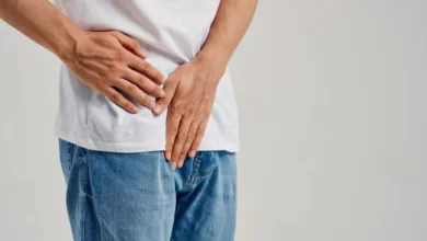 هل دوالي الخصية تزول مع الوقت بدون جراحة؟ دكتور أسامة حتة